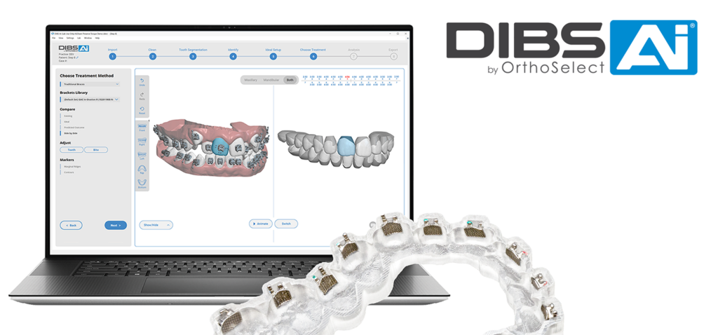 la technologie DIBS AI en orthodontie, montrant l'intégration de l'intelligence artificielle avec des brackets métalliques pour améliorer la précision des traitements.