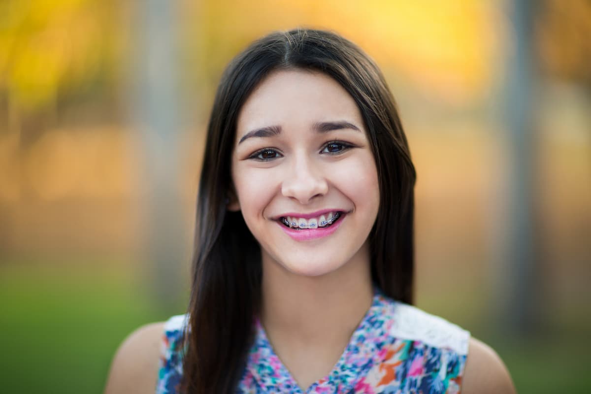 Fille portant un appareil d'orthodontie avec des brackets métalliques, symbolisant un traitement d'alignement dentaire précis et efficace.